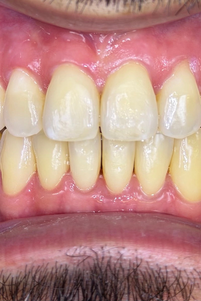 This patient after treatment