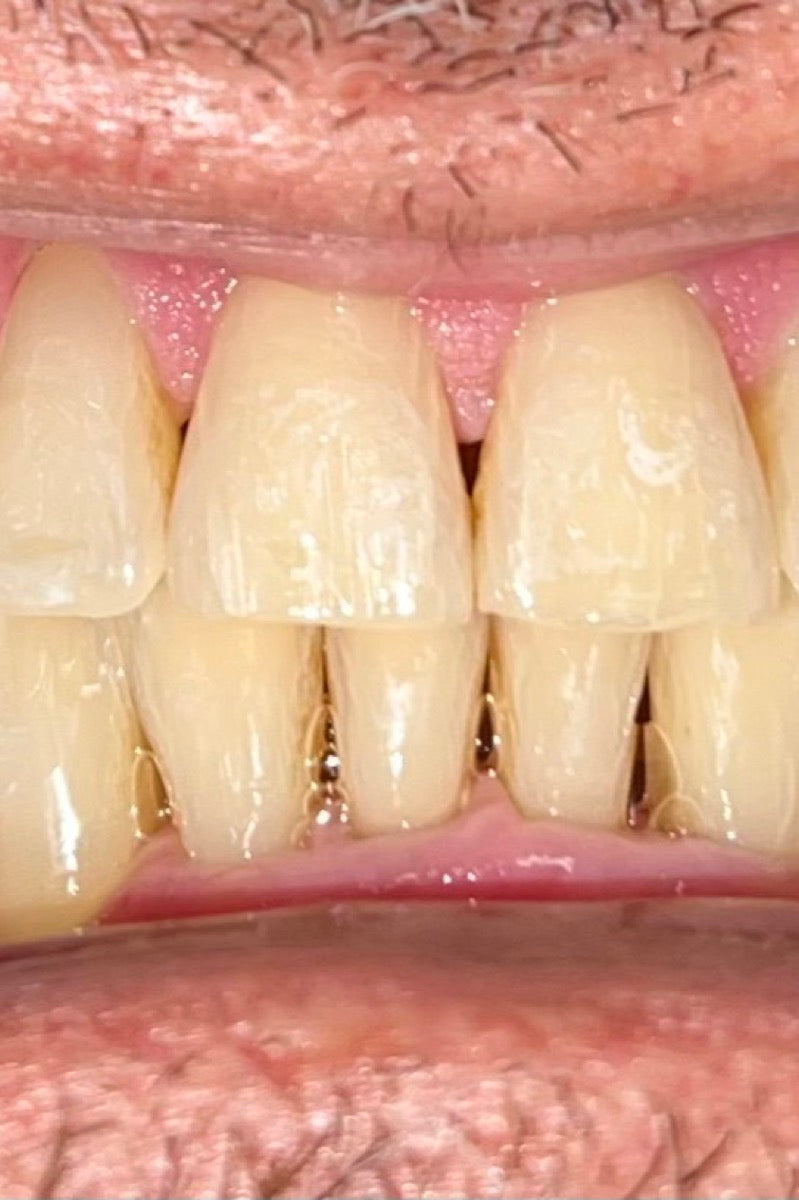This patient after treatment